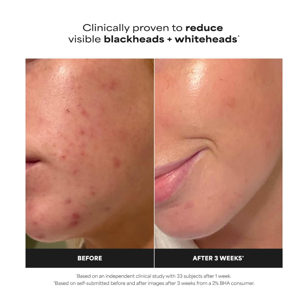Paula's Choice Skin Perfecting 2% BHA Liquid Exfoliant 118mL