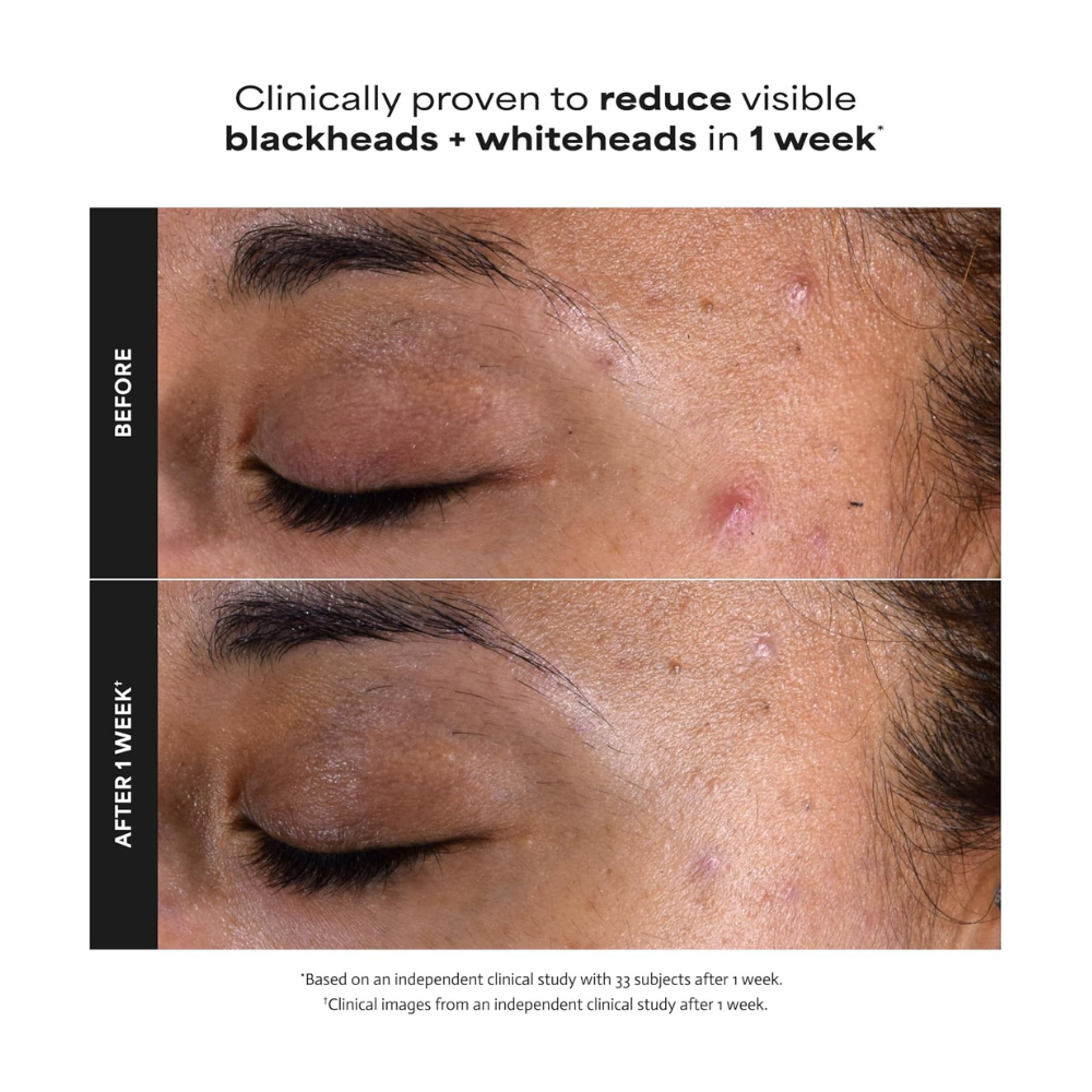 Paula's Choice Skin Perfecting 2% BHA Liquid Exfoliant 118mL